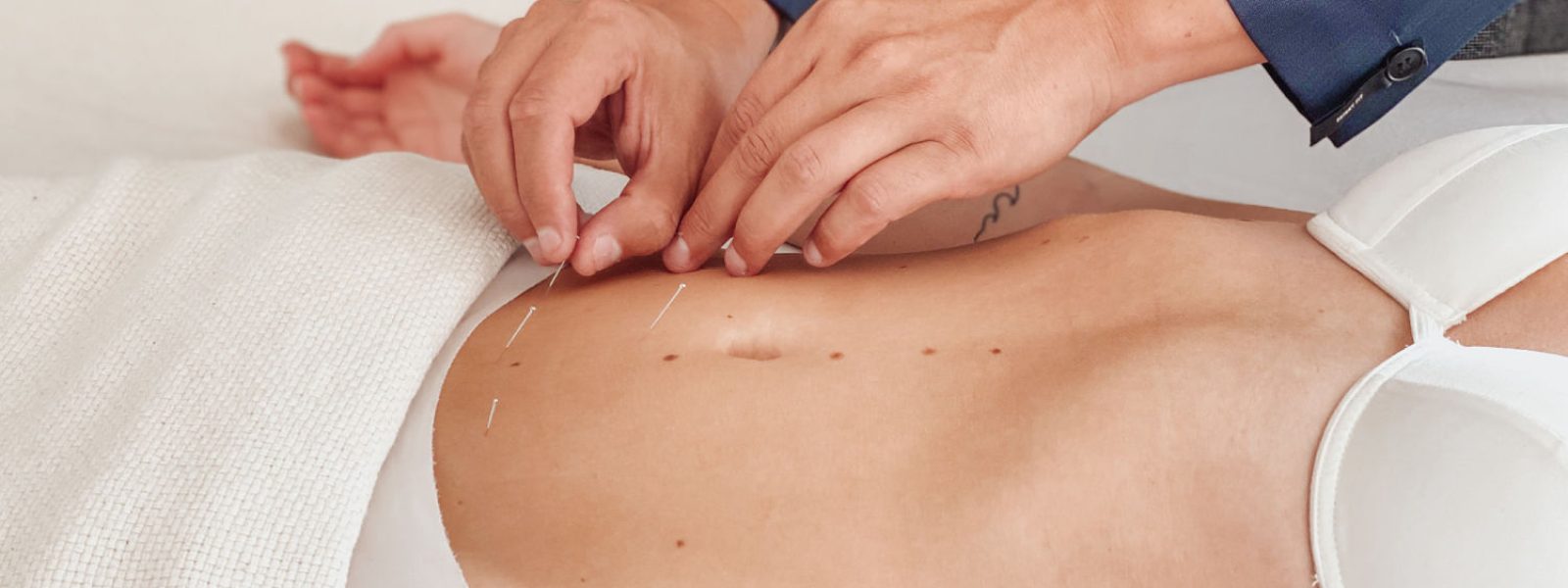 akupunktur Fertilitetsbehandling